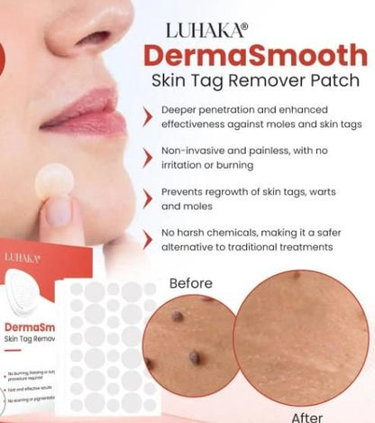 Skin Tag Remover Patch